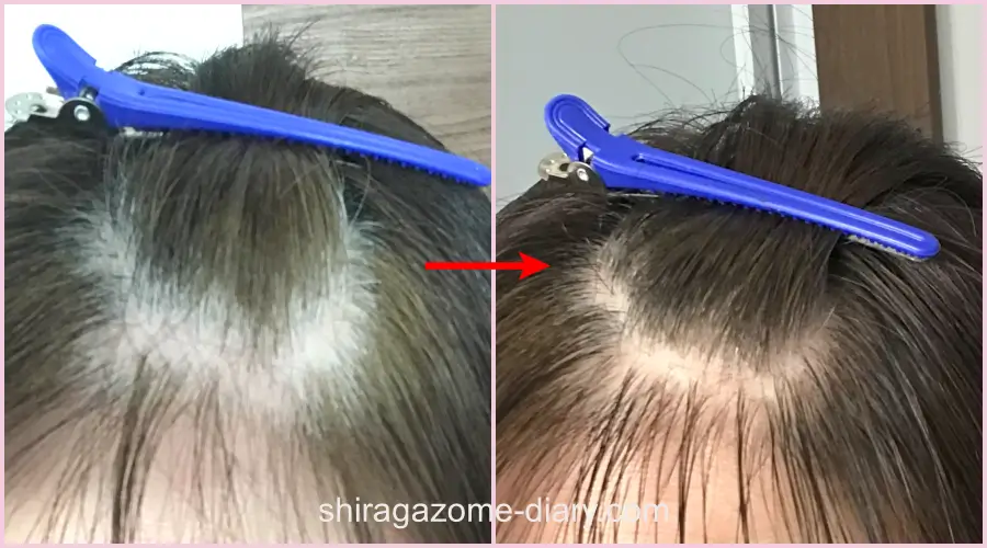 ブローネヘアマスカラを使用する前と使用後の前髪の比較画像