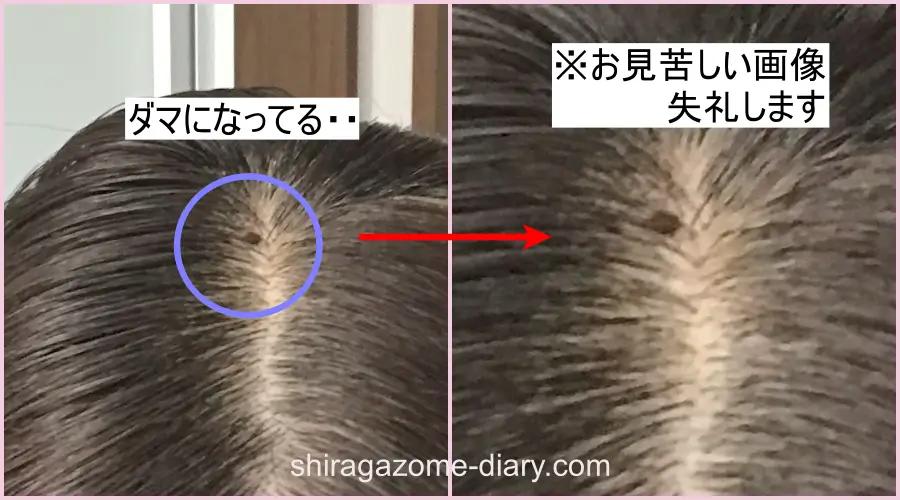 ブローネヘアマスカラを使ってダマになった液が付いた頭頂部の画像